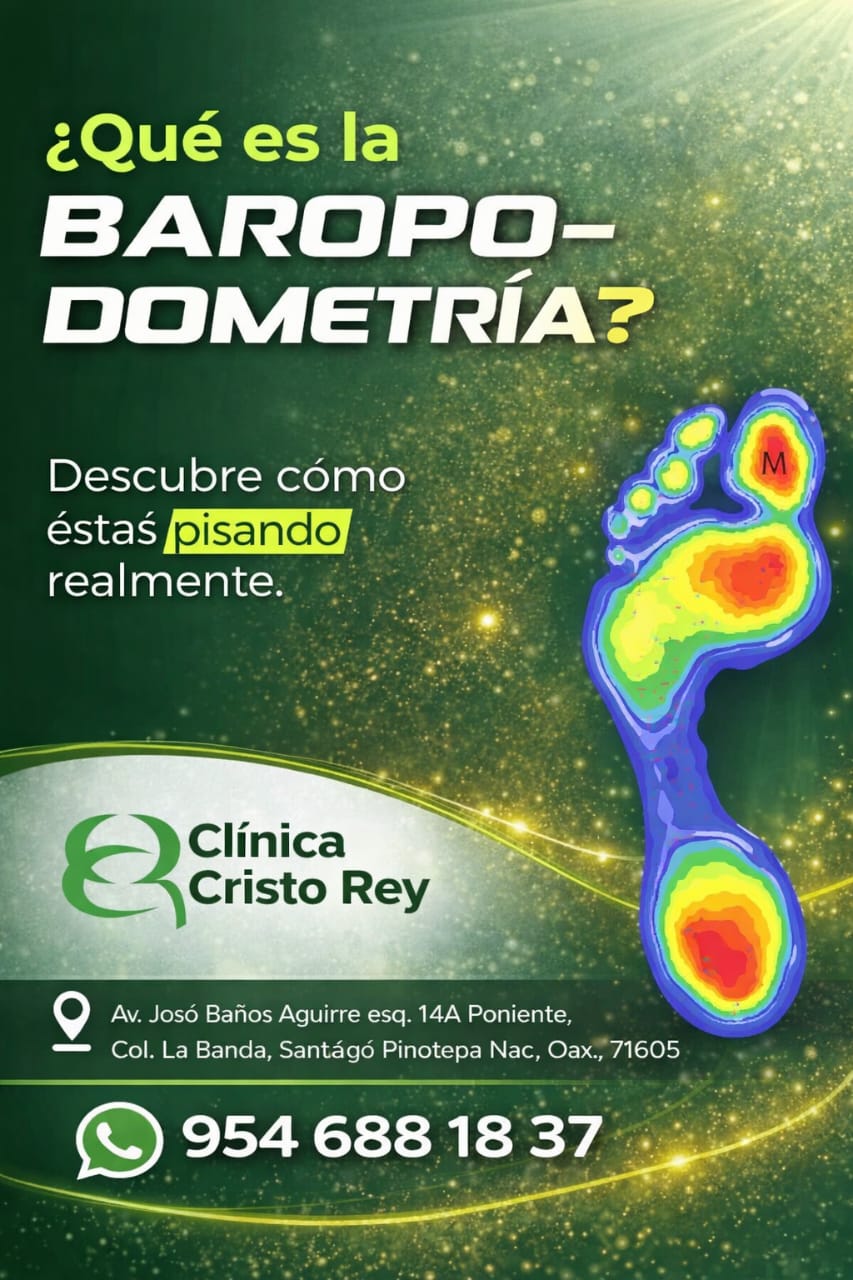 Baropodometría: qué es y cómo pisas